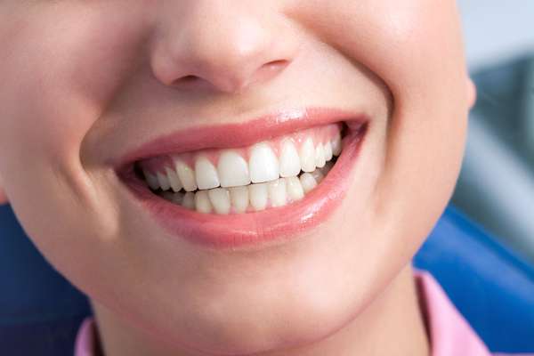 A General Dentist Discusses the Benefits of Tooth Straightening from Michael M. Bohn, DDS in Fresno, CA