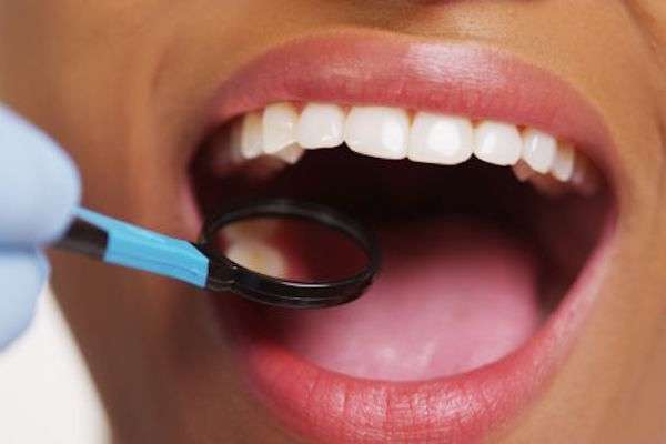 How a General Dentist Treats Cavities from Michael M. Bohn, DDS in Fresno, CA