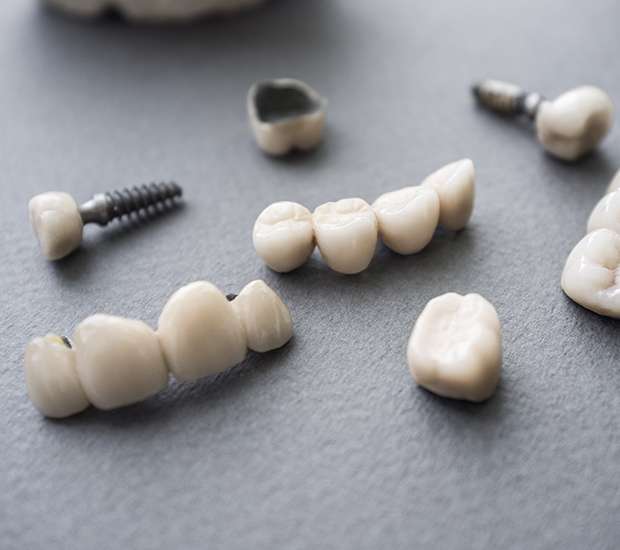Fresno The Difference Between Dental Implants and Mini Dental Implants